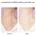 Masajeador Reafirmante Facial Y De Cuello Rejuvenecedor Envió Gratis - Imagen 5