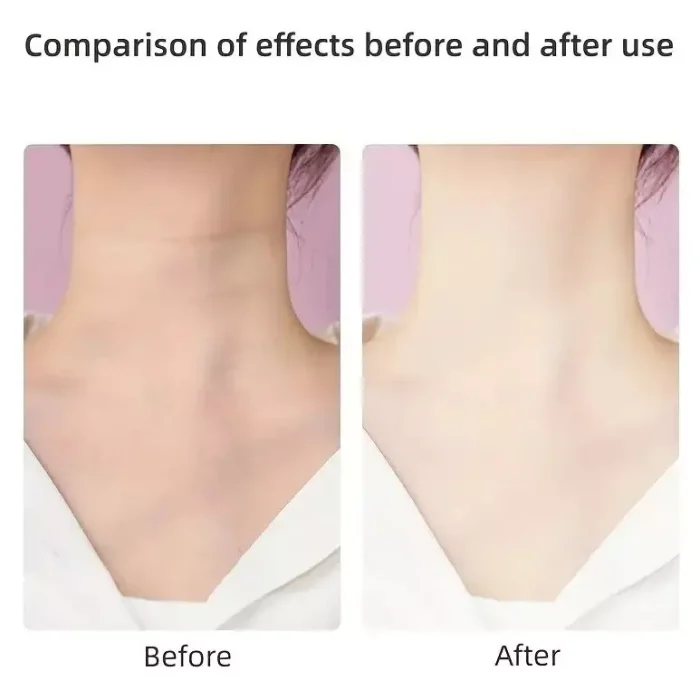 Masajeador Reafirmante Facial Y De Cuello Rejuvenecedor Envió Gratis - Imagen 5
